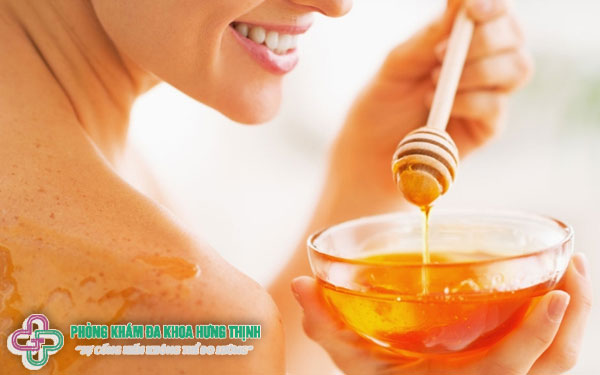 Da bị cháy nắng phải làm thế nào? - Sử dụng mật ong để chữa cháy nắng hiệu quả