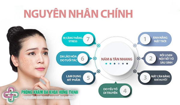 Nguyên nhân bị nám mặt