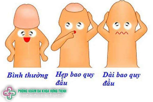 Chưa lột bao quy đầu gây ra những tác hại gì đối với sức khỏe?
