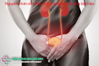 Nguyên nhân dẫn đến tình trạng viêm đường tiết niệu