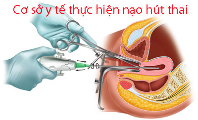 Cơ sở y tế thực hiện nạo hút thai