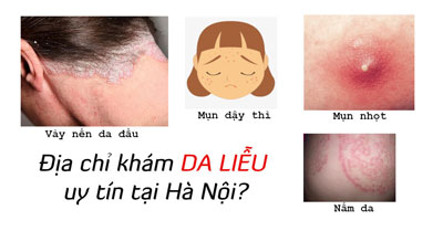 11 Phòng khám da liễu ở Hà Nội gần đây nhất