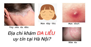 10 Phòng khám da liễu ở Hà Nội gần đây nhất năm 2022