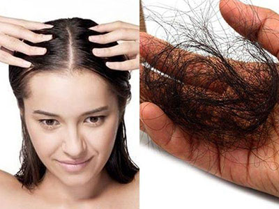 Tóc rụng nhiều