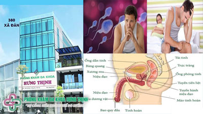 Cách điều trị vô sinh nam hiệu quả