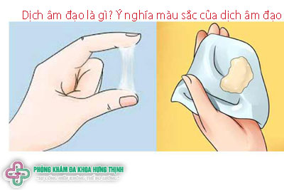 Dịch âm đạo là gì? Ý nghĩa màu sắc của dịch âm đạo