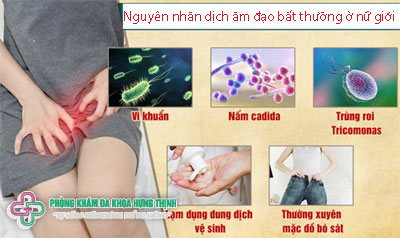 Nguyên nhân dịch âm đạo bất thường ở nữ giới