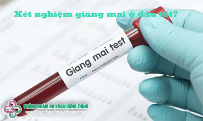 Xét nghiệm giang mai ở đâu tốt?