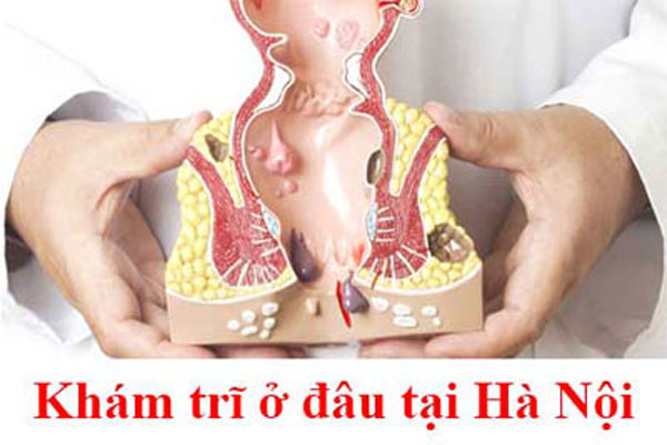Địa chỉ chữa bệnh trĩ uy tín Hà Nội