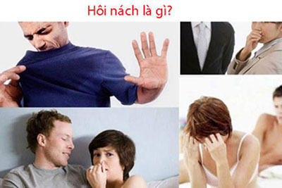 Hôi nách là gì?