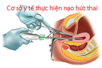 Cơ sở y tế thực hiện nạo hút thai
