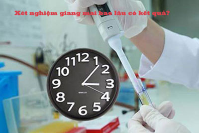 Xét nghiệm giang mai bao lâu có kết quả?