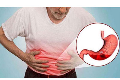 Đau bao tử là gì?