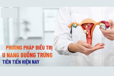 Cách chữa u nang buồng trứng