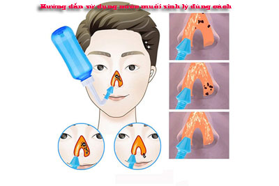 Hướng dẫn sử dụng nước muối sinh lý đúng cách