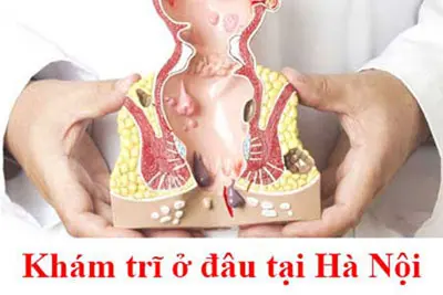 Địa chỉ chữa bệnh trĩ uy tín Hà Nội?