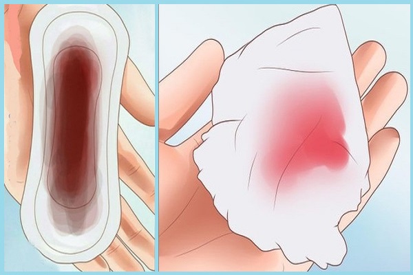 Kinh nguyệt ra nhiều ở tuổi tiền mãn kinh bắt nguồn từ nhiều nguyên nhân