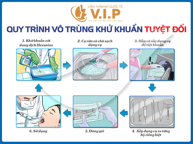 nâng mũi bọc sụn tự thân có vĩnh viễn