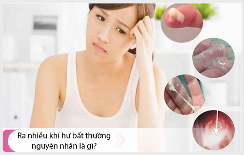 Khí hư là gì? ra nhiều khí hư bất thường nguyên nhân là gì?