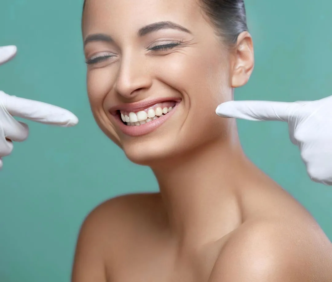 Composite Bonding Birmingham Edgbaston Smile