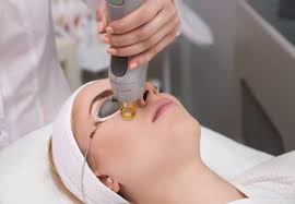 đốt mụn cóc ở đâu là an toàn hiệu quả nhất