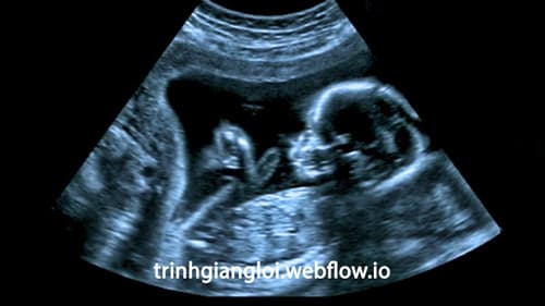 Bệnh giang mai bẩm sinh được truyền qua nhau thai