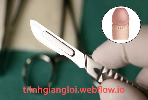 10 Địa chỉ cắt bao quy đầu ở đâu tốt nhất Hà Nội