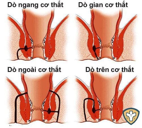 Tiêu chí lựa chọn địa chỉ chữa bệnh rõ hậu môn ở đâu tốt nhất?