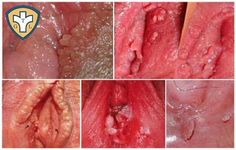 Tiêu chí lựa chọn dia chi chua sui mao ga