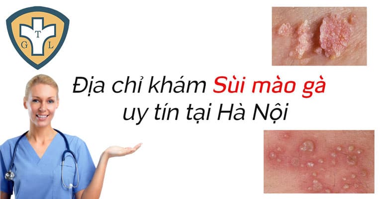 Bệnh viện, phòng khám chữa sùi mào gà ở đâu tốt nhất Hà Nội