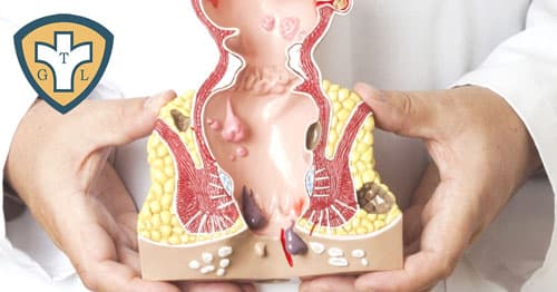 Cắt trĩ ở đâu tốt nhất? Top Phòng khám trĩ tại Hà Nội uy tín