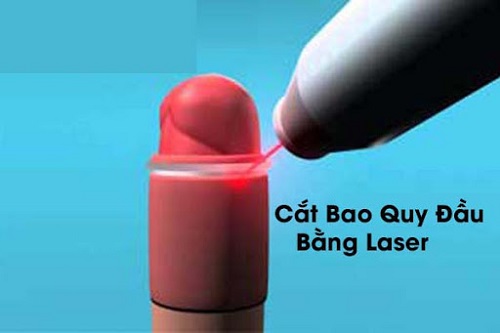 Chi phí phẫu thuật cắt bao quy đầu ở bệnh viện khoảng bao nhiêu tiền?