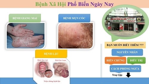 Chi phí xét nghiệm bệnh xã hội bao nhiêu tiền Bảng giá 2020