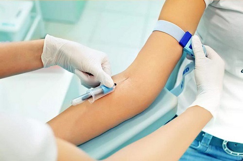 Chi phí xét nghiệm bệnh xã hội bao nhiêu tiền Bảng giá 2020