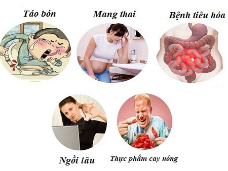 Chi phí phẫu thuật cắt búi trĩ hết bao nhiêu tiền Bảng giá 2020