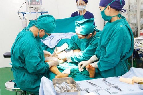 Chi phí phẫu thuật cắt búi trĩ hết bao nhiêu tiền Bảng giá 2020