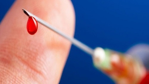 Bệnh lậu là gì? Biểu hiện, triệu chứng, cách điều trị bệnh lậu 10