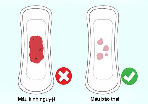 20 Dấu hiệu có thai sớm chính xác nhất sau tuần đầu tiên 1