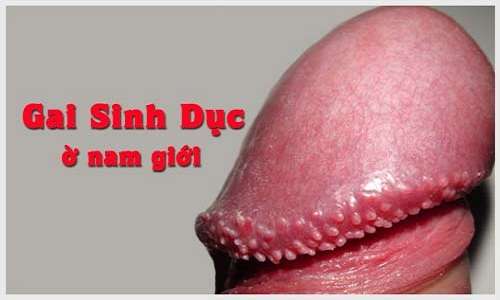 Dương vật nổi mụn đỏ trắng ngứa là bệnh gì 8