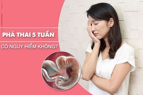 Phá thai 5 tuần tuổi có được không cách nào an toàn hiệu quả 7