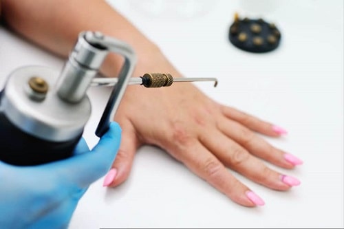 Mụn cóc là gì cách trị mụn cóc ở tay chân tại nhà nhanh khỏi nhất 9
