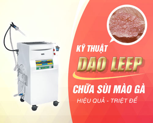 12 Địa chỉ khám chữa sùi mào gà ở đâu tốt nhất Hà Nội 21