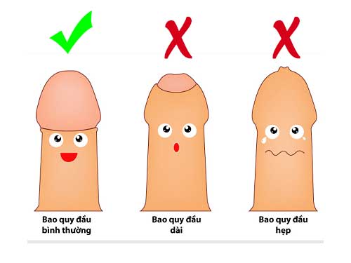 8 Cách chữa viêm bao quy đầu an toàn hiệu quả nhanh nhất hiện nay