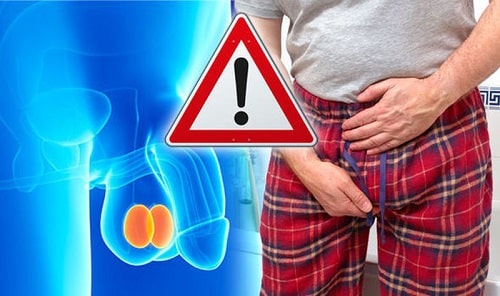 Đau tinh hoàn nguyên nhân là gì khám ở đâu tốt nhất