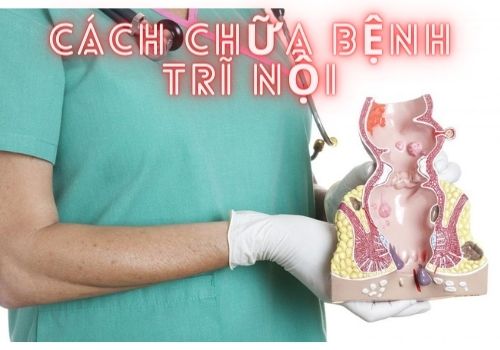 10 Cách chữa bệnh trĩ nội hiệu quả nhất điều trị trĩ nội nhanh chóng 2