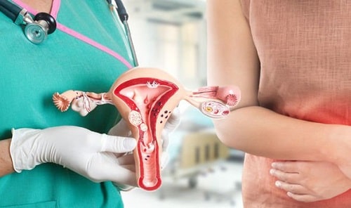 Viêm phụ khoa nguyên nhân ảnh hưởng và cách chữa trị triệt để 6