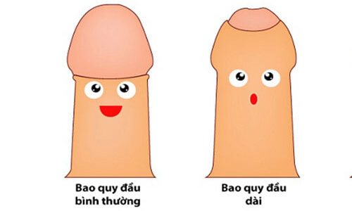 Dài bao quy đầu là gì?