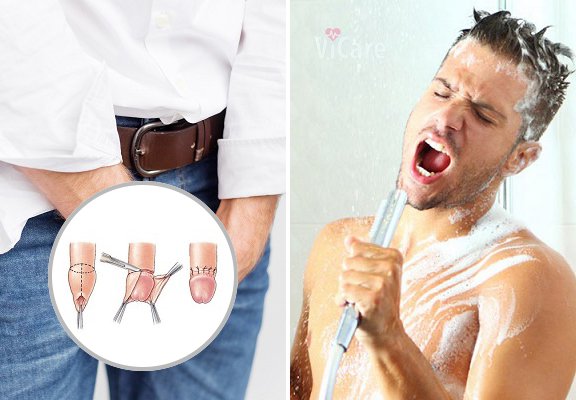 Bệnh vùng kín nam giới là bệnh gì