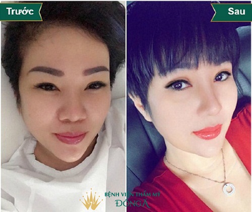 Topics tagged under 1 on Diễn đàn Tuổi trẻ Việt Nam | 2TVN Forum 5d0da3708a90688906000b09_park-hyo-jin-8-2-1