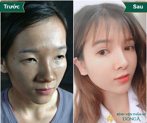Các tướng mũi phú quý mang lại Giàu Sang và Cách để sở hữu nó - Hình 2